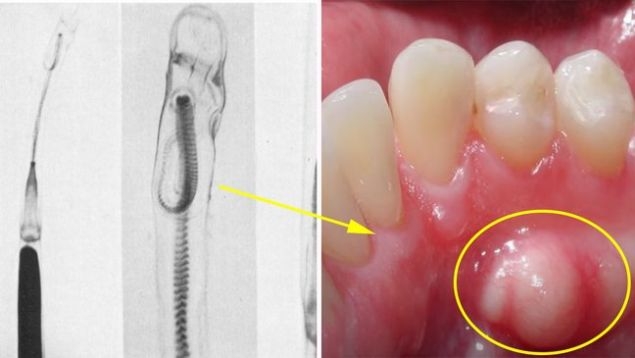 Doktorlar bile inanamadı! ondan hamile kaldı 5