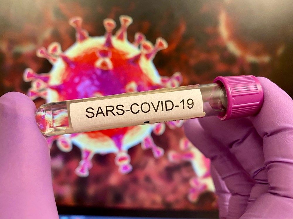 Çinli uzman uyardı: Dünya koronavirüsten daha kötü salgınlarla yüzleşece 7