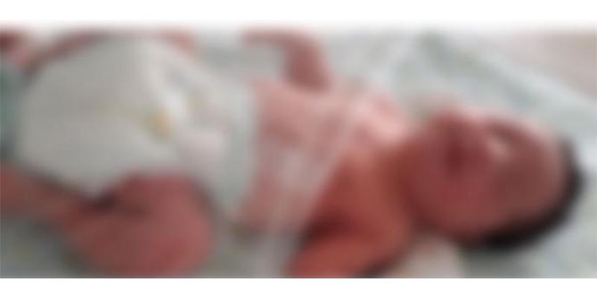 Antalya'da başına saçma isabet eden 2 aylık bebek öldü