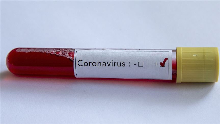 Kasımpaşa'da 7 oyuncu koronavirüse yakalandı