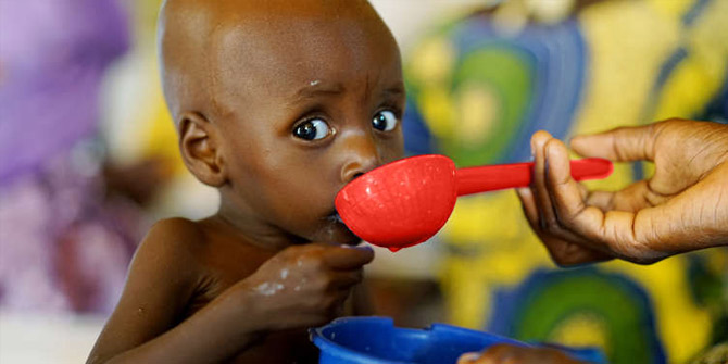 Dünyada 1,2 milyar çocuk yoksulluk ve hastalık riski altında