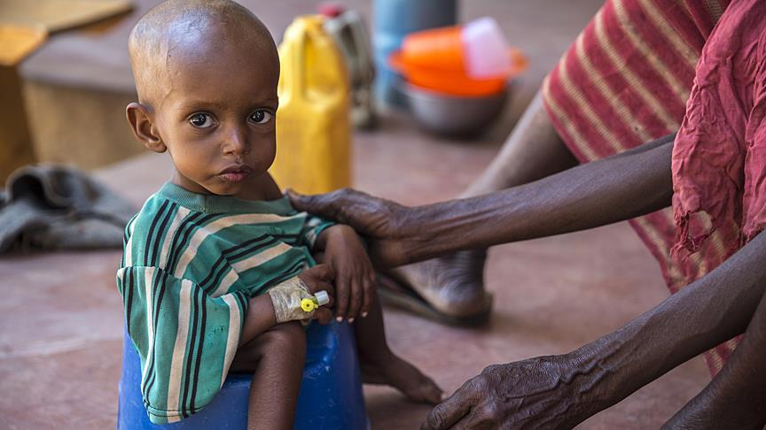 Somali’de 4,2 milyon kişi yardıma muhtaç