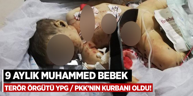 9 aylık Muhammed bebek terör örgütü YPG/PKK'nın kurbanı oldu