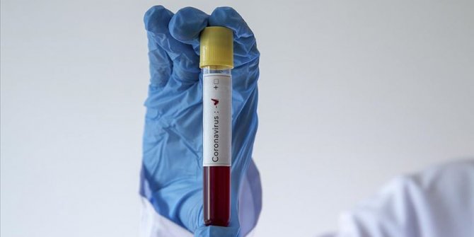 Irak'ta koronavirüsü yenen bir kişi hastaneden taburcu edildi