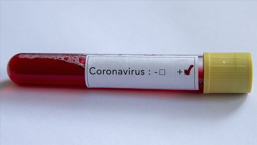 Dünya genelinde yeni tip koronavirüs bulaşan kişi sayısı 423 bini geçti