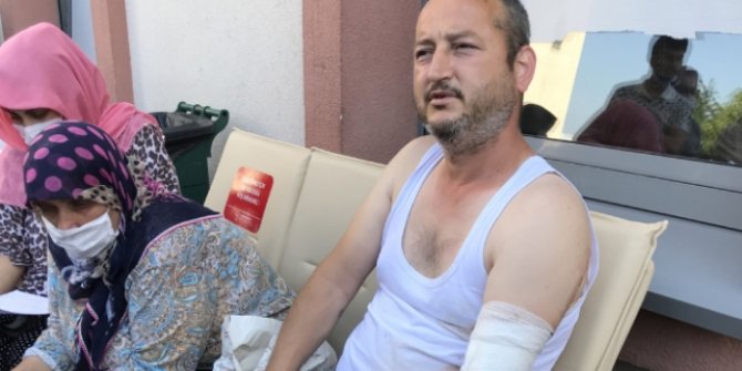 Sakarya'daki patlamada yaralanan işçi olay anını anlattı