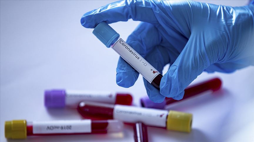İskoçya ekibi St. Mirren'de 7 kişide koronavirüs tespit edildi