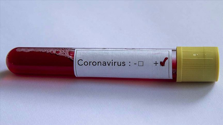 MotoGP'de bir kişide koronavirüs tespit edildi